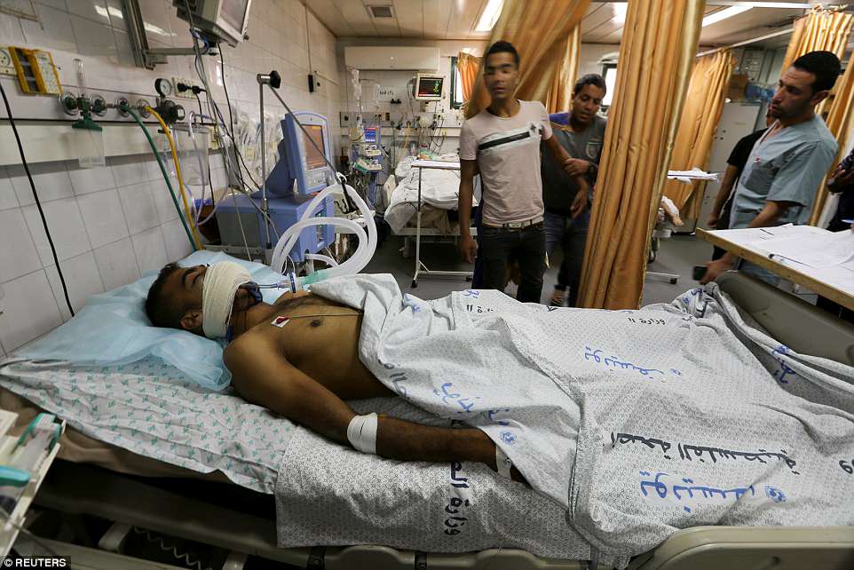 اسرائیلی فوج کا آنسوگیس کا شیل فلسطینی نوجوان کے منہ پرجا لگا